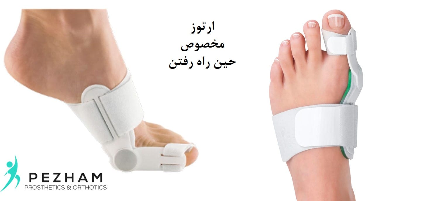 هالوکس والگوس.انحراف شست پا.قوز شست پا