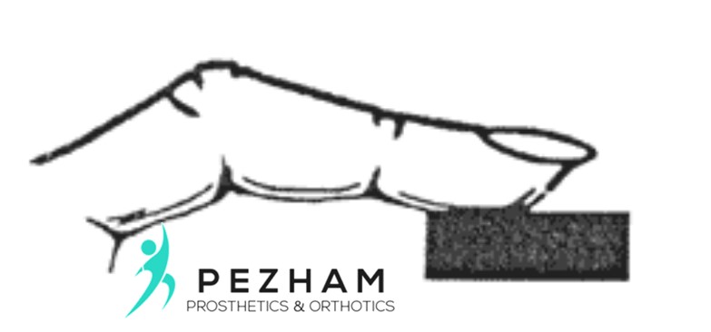 انگشت چکشی دست