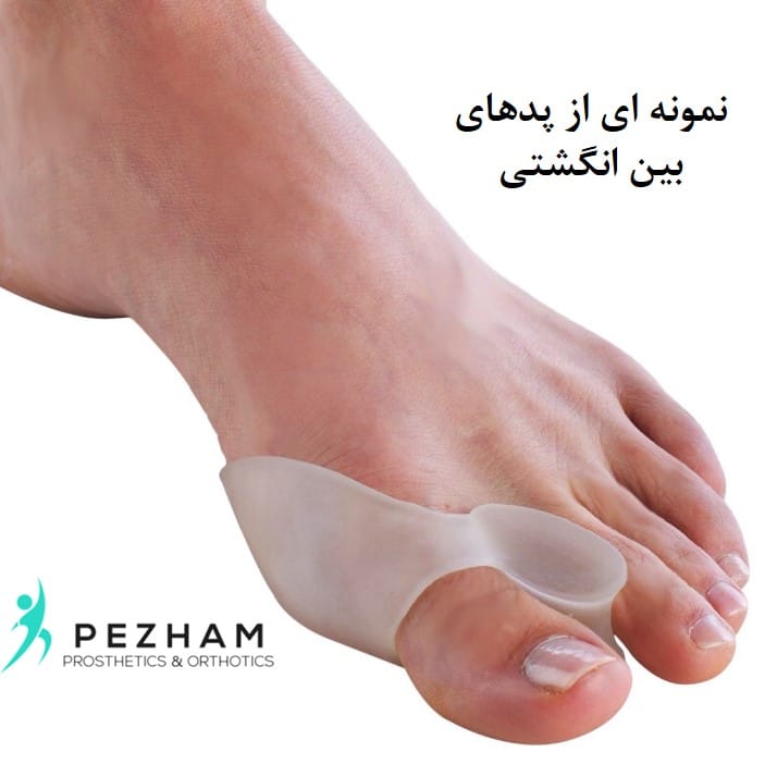 هالوکس والگوس.انحراف شست پا.قوز شست پا