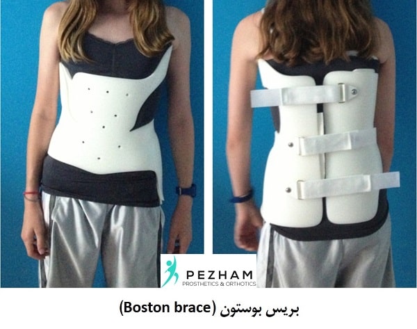 بریس بوستون.بریس اسکولیوز.درمان اسکولیوز.اسکولیوز