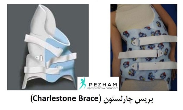 بریس چارلستون.بریس اسکولیوز.درمان اسکولیوز.اسکولیوز