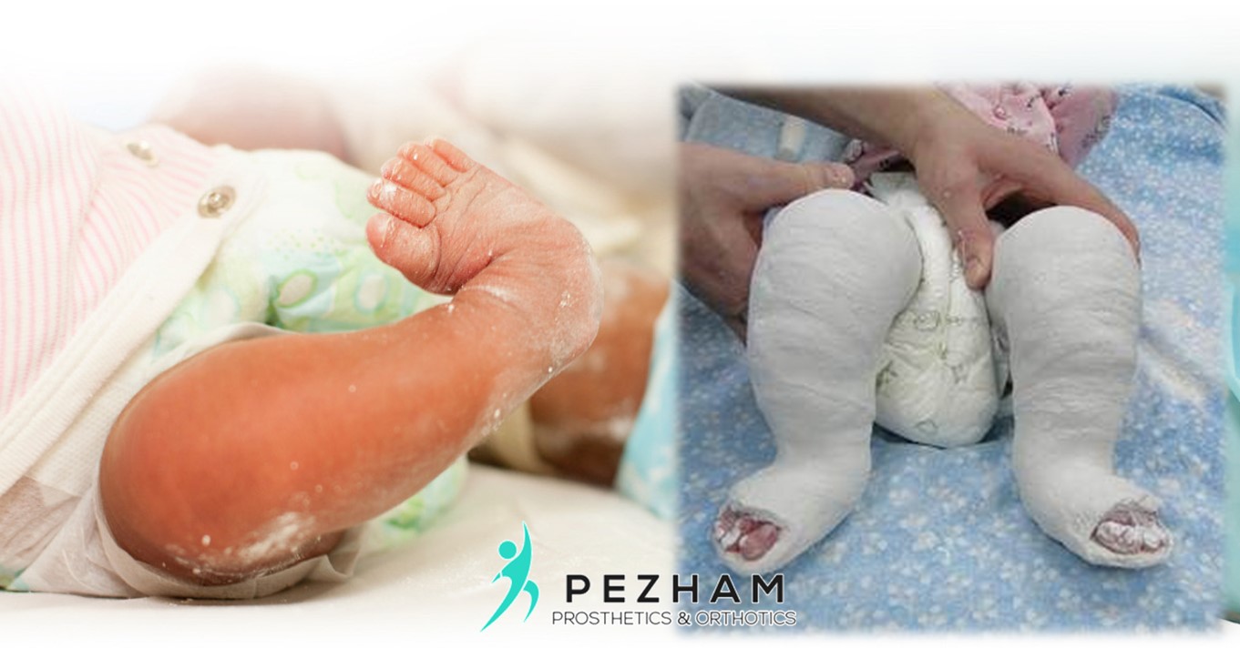 گچ گیری کلاب فوت