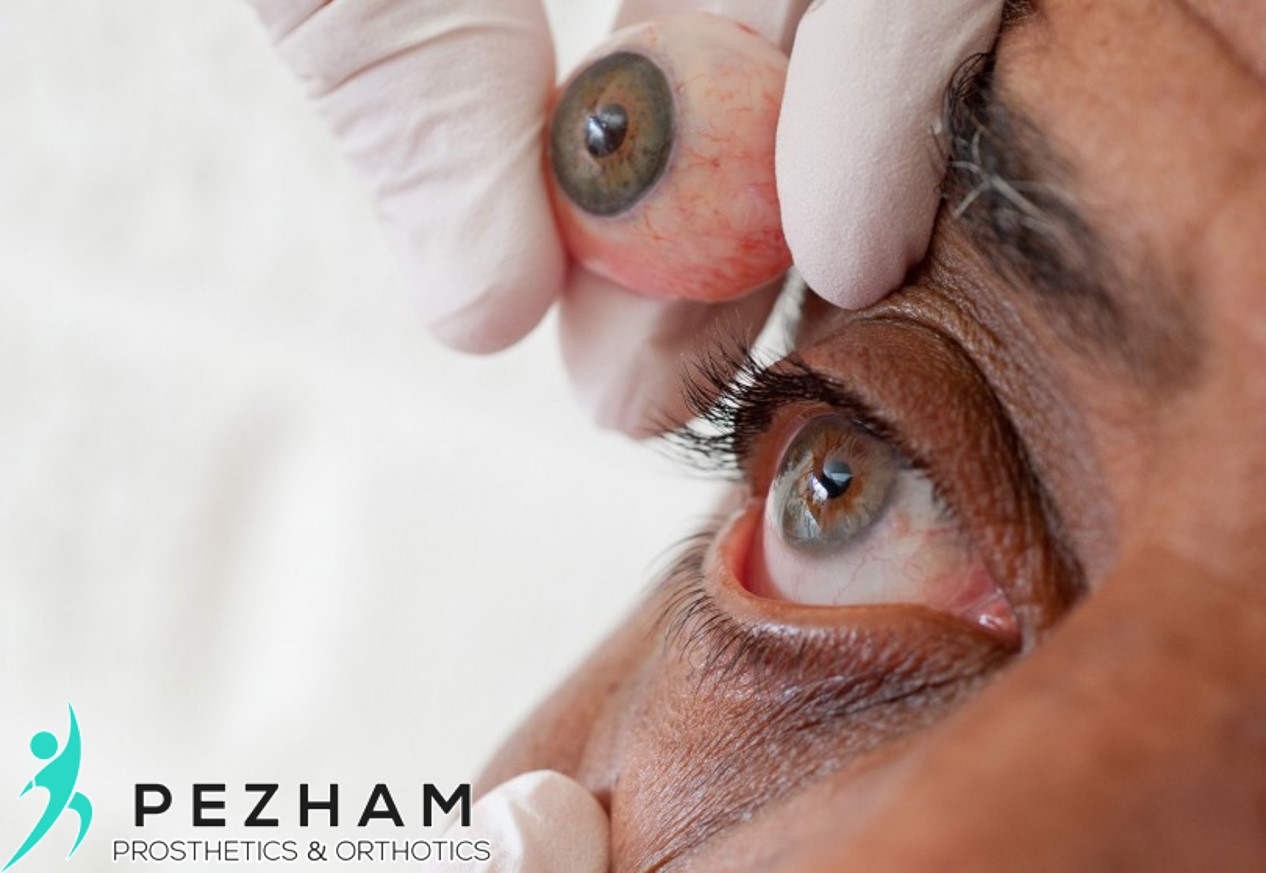 پروتز چشم.پروتز زیبایی چشم.چشم مصنوعی