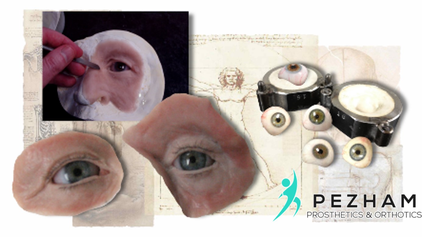 پروتز چشم.پروتز زیبایی چشم.چشم مصنوعی