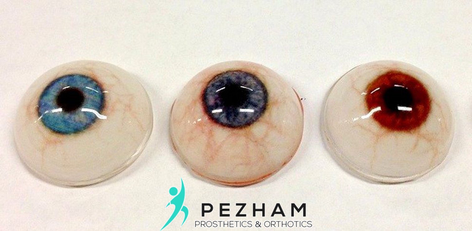 پروتز چشم.پروتز زیبایی چشم.چشم مصنوعی
