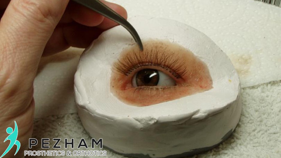 پروتز چشم.پروتز زیبایی چشم.چشم مصنوعی