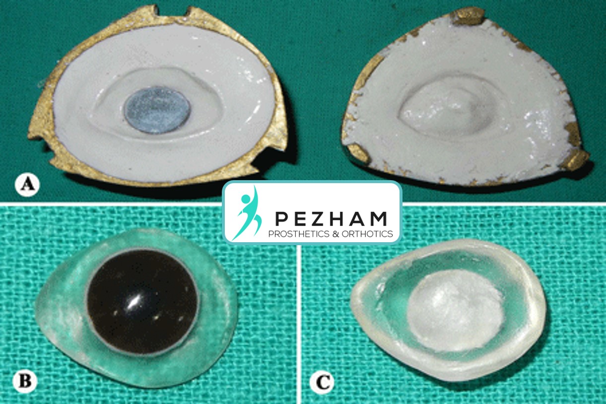 پروتز چشم.پروتز زیبایی چشم.چشم مصنوعی