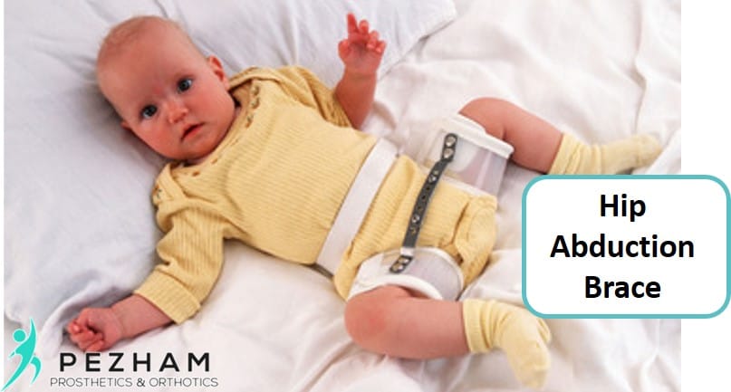 بریس دور کننده ران در درمان دررفتگی مادرزادی لگن
