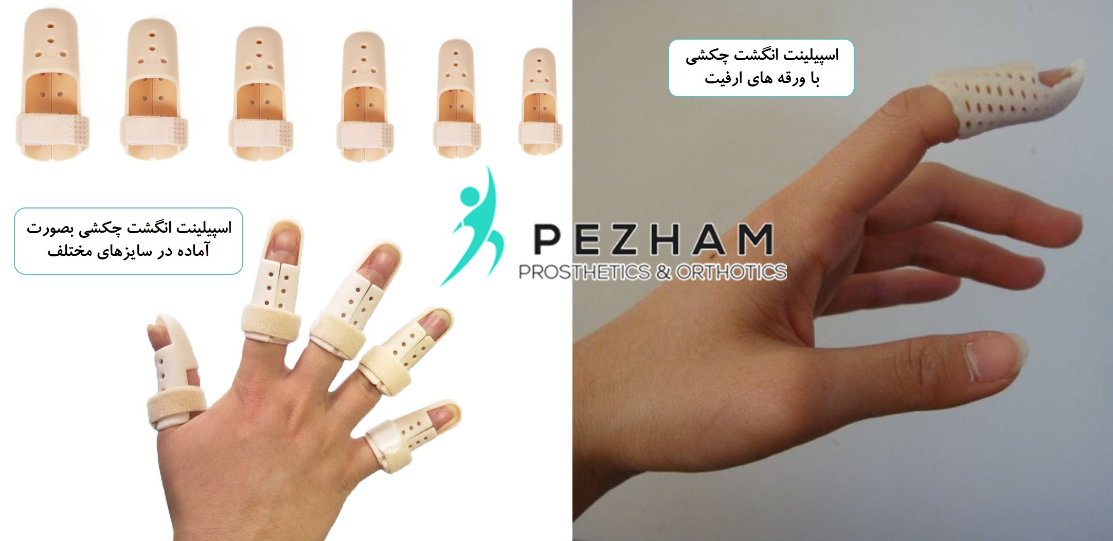 انگشت چکشی دست