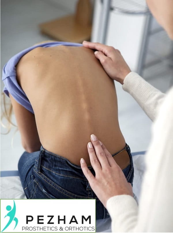 اسکولیوز.انحراف جانبی ستون فقرات